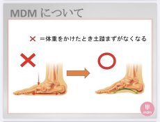 画像7: 【MDM】 (3) Professional (7)